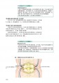 骨折复位内固定术